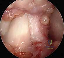 التجهيز للتدخل الجراحي الدقيق