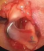 الدقة والاحترافية في غرفة العمليات