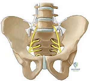 S-Rod Fixation to the Pelvis: A Masterclass in Neuromuscular Spinal Deformity Correction