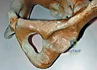 صورة توضيحية لعدم تناسق طيات الجلد