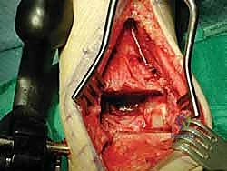 القياس الدقيق لحجم الطعم المطلوب