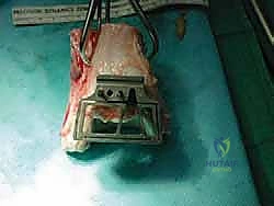 تجهيز السطح المفصلي للمريض