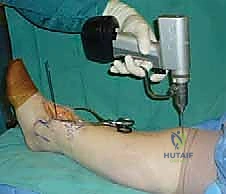 سحب وحماية الأنسجة الحيوية