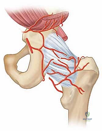 Illustration of hip in children - Dr. Mohammed Hutaif