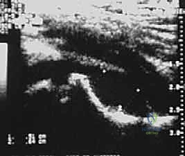 فحوصات مخبرية وأشعة سينية مبدئية