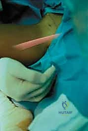 تحضير المريض للتدخل الجراحي الطارئ