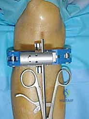 تثبيت المكونات التجريبية