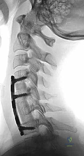 متابعة المريض في فترة النقاهة داخل المستشفى