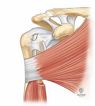 صورة توضيحية لـ التهاب وتر العضلة ذات الرأسين بالكتف: الأسباب، الأعراض، وخيارات العلاج بالمنظار مع الأستاذ الدكتور محمد هطيف