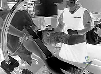 استخدام جهاز الأشعة داخل غرفة العمليات