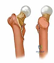 التحقق من وضعية السلك بالأشعة