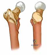 قياسات دقيقة قبل الجراحة