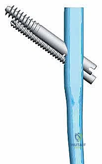التأكد من عمق المسمار