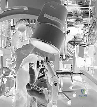 صورة شعاعية تؤكد استقرار المسمار اللولبي