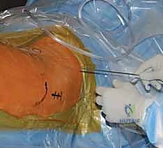 قياس طول المسمار المطلوب