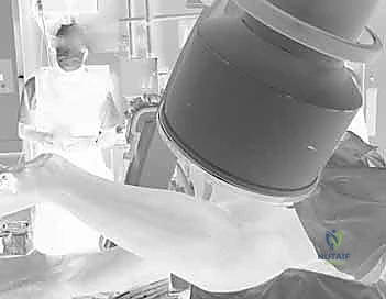 إدخال السلك الدليلي للمسمار العنقي