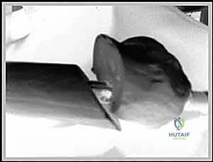 تحديد نقطة الدخول للمسمار النخاعي