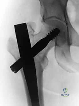 تثبيت الأداة الموجهة