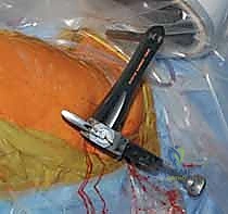 صورة شعاعية للمسمار السفلي