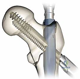 التأكد من التثبيت النهائي للرأس