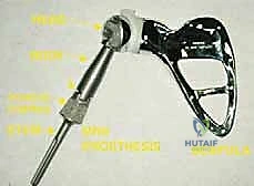 Intraoperative Surgical Step