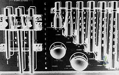 استئصال الورم ككتلة واحدة