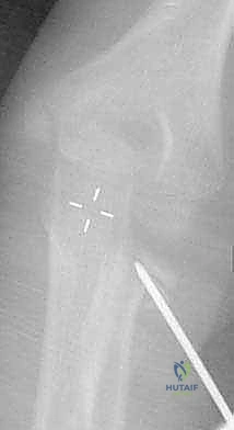 Clinical Image