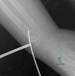 الفحص السريري وتحديد موقع الألم