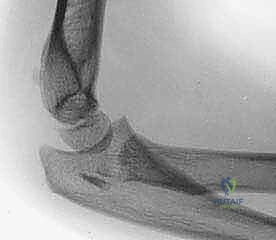 Clinical Image