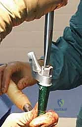 إزالة المفصل القديم والتحضير