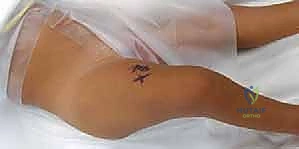 توضيح تشريحي لزوايا الحوض