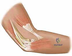 مواقع الاختناق العصبية حول المرفق