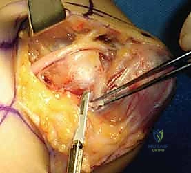 العلاقات الوعائية العصبية في المرفق