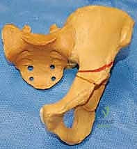 تأثير العوامل الميكانيكية على نمو الورك