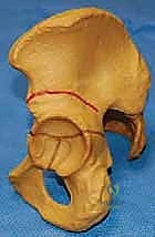 أجهزة التثبيت التحفظية