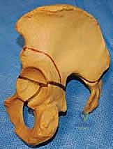 تطور الخلع مع تقدم العمر