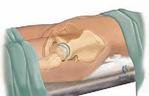 مخطط تقنية ديجا