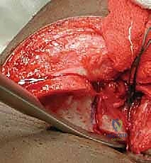 التعقيم وتجهيز المريض