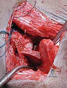 مقارنة شعاعية بين التقنيات