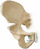 صورة أشعة بعد التئام العظم