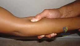 Illustration of radial tunnel syndrome - Dr. Mohammed Hutaif