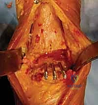 رسم تشريحي مفصل يوضح عظام الكاحل والغضاريف