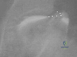 تقييم حركية المفصل بعد فترة التأهيل