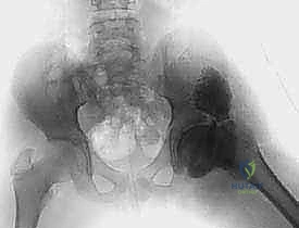 تحضير الأدوات الجراحية المتقدمة