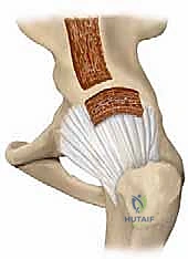 تقييم حالة المفصل أثناء الجراحة
