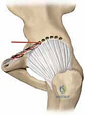 Intraoperative Surgical Step