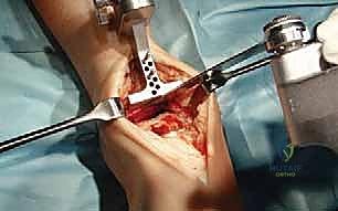 الأستاذ الدكتور محمد هطيف