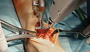 أفضل جراح عظام في اليمن