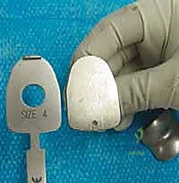 تخطيط جراحة استبدال الكاحل