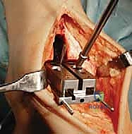 العودة للأنشطة اليومية